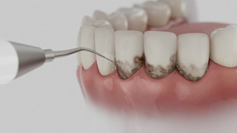Reliable Wisdom Tooth Removal contractor in Wheeler County County, GA by Dentist Open Now